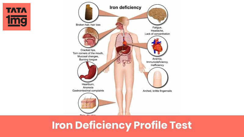 Iron Deficiency Profile